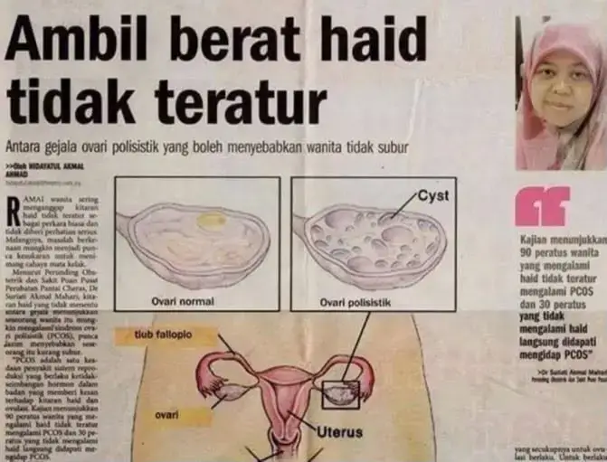 Petikan berita mengenai kesihatan dalaman wanita